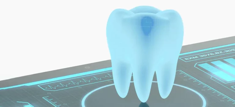 Цифровые системы планирования лечения зубов